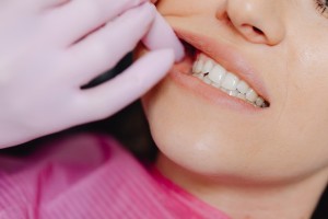 botox tegen tandenknarsen